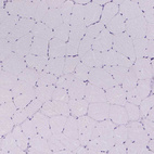 Immunohistochemical staining of human skeletal muscle shows no positivity in myocytes as expected.