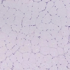 Immunohistochemical staining of human skeletal muscle shows no positivity in myocytes as expected.