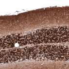 Immunohistochemical staining of mouse brain shows strong cytoplasmic positivity in cells in granular layer.
