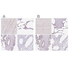 Anti-HEXB Antibody