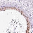 Anti-HEXB Antibody