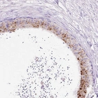 Immunohistochemical staining of human epididymis shows strong granular cytoplasmic positivity in glandular cells.