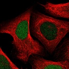 Immunofluorescent staining of human cell line U-2 OS shows localization to nucleus.