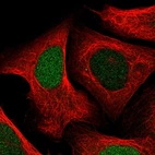 Immunofluorescent staining of human cell line U-2 OS shows localization to nucleus.