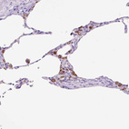 Anti-HEXB Antibody