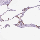 Immunohistochemical staining of human lung shows strong granular cytoplasmic positivity in macrophages.