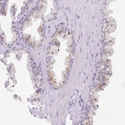Immunohistochemical staining of human prostate shows strong granular cytoplasmic positivity in glandular cells.