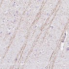 Immunohistochemical staining of human cerebral cortex shows moderate positivity in neuronal processes in neuronal cells.