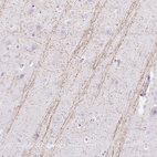 Anti-HEXB Antibody