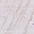 Immunohistochemical staining of human cerebral cortex shows moderate positivity in neuronal processes in neuronal cells.