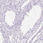 Anti-HEXB Antibody