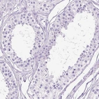 Immunohistochemical staining of human testis shows no positivity in cells in seminiferous ducts.