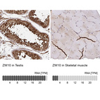 Anti-ZW10 Antibody