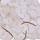 Immunohistochemical staining of human skeletal muscle shows low expression as expected.