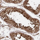 Immunohistochemical staining of human testis shows high expression.