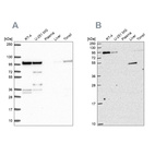 Anti-ZW10 Antibody