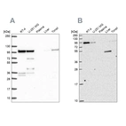 Western blot analysis using Anti-ZW10 antibody HPA055410 (A) shows similar pattern to independent antibody HPA051253 (B).