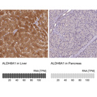 Anti-ALDH8A1 Antibody