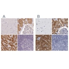 Immunohistochemical staining of human cerebral cortex, kidney, liver and lymph node using Anti-ALDH8A1 antibody HPA055414 (A) shows similar protein distribution across tissues to independent antibody HPA026292 (B).