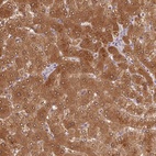 Immunohistochemical staining of human liver shows high expression.