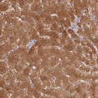 Anti-ALDH8A1 Antibody