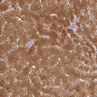 Immunohistochemical staining of human liver shows high expression.