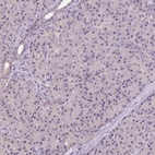 Anti-ALDH8A1 Antibody