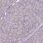 Immunohistochemical staining of human pancreas shows low expression as expected.