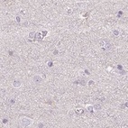 Immunohistochemical staining of human cerebral cortex using Anti-ALDH8A1 antibody HPA055414.