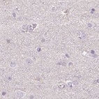 Anti-ALDH8A1 Antibody