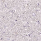 Immunohistochemical staining of human cerebral cortex using Anti-ALDH8A1 antibody HPA055414.