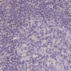 Immunohistochemical staining of human lymph node using Anti-ALDH8A1 antibody HPA055414.