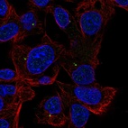 Anti-ALDH8A1 Antibody