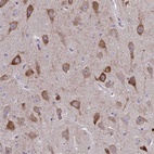 Anti-SPATS2L Antibody