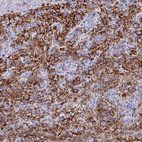 Anti-FCGR3A Antibody