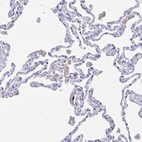 Anti-FCGR3A Antibody