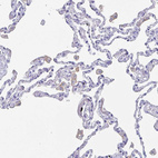 Immunohistochemical staining of human lung shows weak membranous positivity in macrophages.