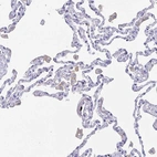 Immunohistochemical staining of human lung shows weak membranous positivity in macrophages.
