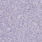 Anti-FCGR3A Antibody