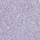 Immunohistochemical staining of human pancreas shows no positivity in exocrine glandular cells as expected.