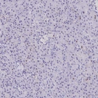 Immunohistochemical staining of human pancreas shows no positivity in exocrine glandular cells as expected.