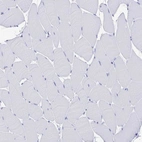 Immunohistochemical staining of human skeletal muscle shows no positivity in myocytes as expected.