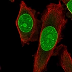 Immunofluorescent staining of human cell line PC-3 shows localization to nucleus, nucleoli & nuclear membrane.