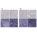 Anti-UHRF1 Antibody