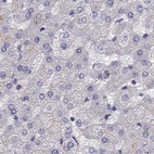 Immunohistochemical staining of human liver using Anti-UHRF1 antibody HPA055446.