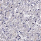 Immunohistochemical staining of human liver using Anti-UHRF1 antibody HPA055446.