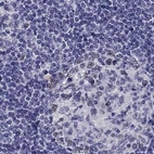 Immunohistochemical staining of human lymph node using Anti-UHRF1 antibody HPA055446.