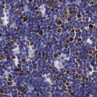 Immunohistochemical staining of human thymus using Anti-UHRF1 antibody HPA055446.