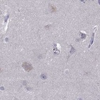 Immunohistochemical staining of human cerebral cortex using Anti-UHRF1 antibody HPA055446.