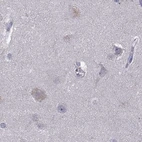 Immunohistochemical staining of human cerebral cortex using Anti-UHRF1 antibody HPA055446.